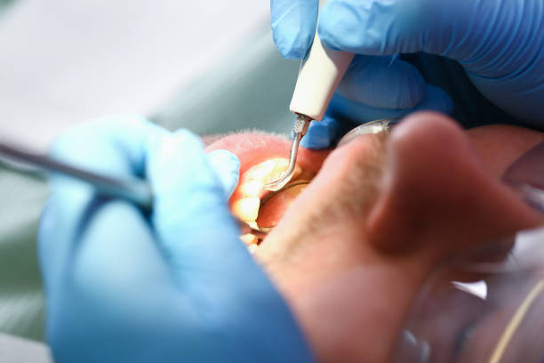 Best Emergency Dental Care for Sports Injuries in Frazer, PA